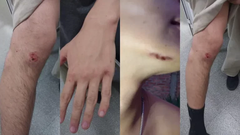 Junín de los Andes: Denuncian brutal golpiza de la GEOP a jóvenes