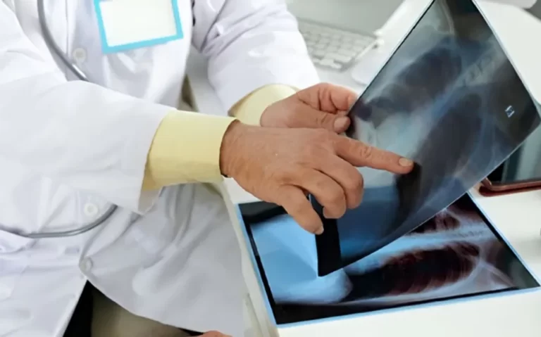 Salud recuerda que la tuberculosis se puede prevenir y curar