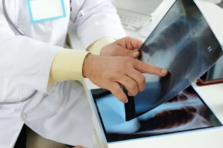 Todos los establecimientos de salud realizan análisis de tuberculosis